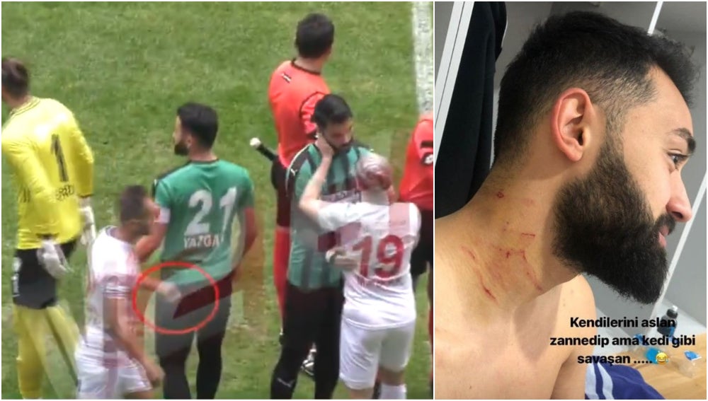 Un futbolista salta al campo con una cuchilla y raja a varios rivales en pleno partido Un futbolista salta al campo con una cuchilla y raja a varios rivales en pleno partido