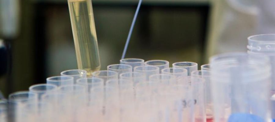 Una probeta en un laboratorio Una probeta en un laboratorio