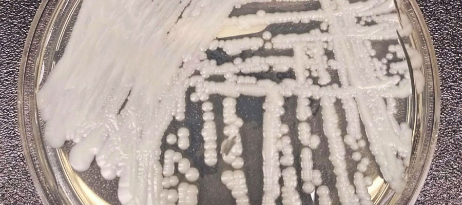 El hongo 'Candida auris' cultivado en los Centros para el Control y la prevención de Enfermedades (CDC) El hongo 'Candida auris' cultivado en los Centros para el Control y la prevención de Enfermedades (CDC)