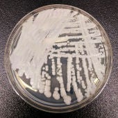 El hongo 'Candida auris' cultivado en los Centros para el Control y la prevención de Enfermedades (CDC)