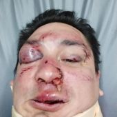 El periodista Sebastián Acosta, tras ser agredido