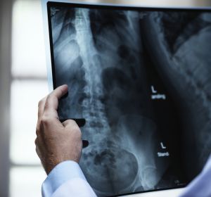 Radiólogo analizando una radiografía Radiólogo analizando una radiografía