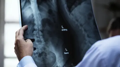 Radiólogo analizando una radiografía Radiólogo analizando una radiografía