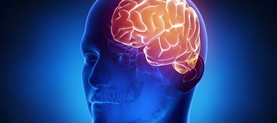 Cerebro Cerebro