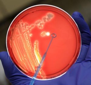 Un asistente de laboratorio examina una colonia de bacterias en un cultivo Un asistente de laboratorio examina una colonia de bacterias en un cultivo