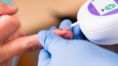 Descubren como mejorar los trasplantes para tratar la diabetes tipo 1