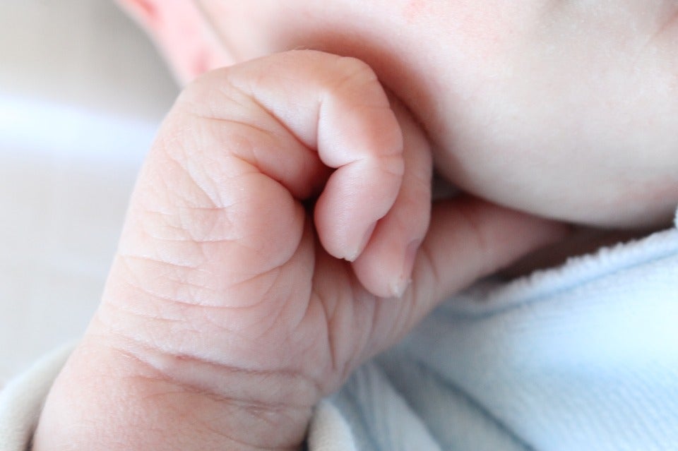 Los dermatólogos aseguran que el vello de los niños con hipertricosis se caerá al dejar el fármaco Los dermatólogos aseguran que el vello de los niños con hipertricosis se caerá al dejar el fármaco