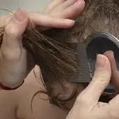 piojos piojos