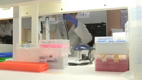 Sanidad finaliza el seguimiento del brote de listeriosis Sanidad finaliza el seguimiento del brote de listeriosis
