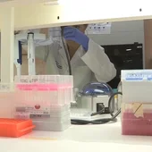 Sanidad finaliza el seguimiento del brote de listeriosis Sanidad finaliza el seguimiento del brote de listeriosis
