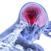 Ictus Ictus