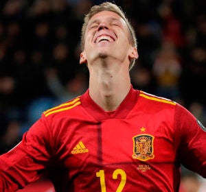 Dani Olmo Dani Olmo