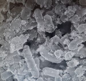 Bacterias de la aceituna ayudan a retirar metales toxicos del intestino Bacterias de la aceituna ayudan a retirar metales toxicos del intestino