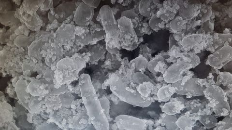 Bacterias de la aceituna ayudan a retirar metales toxicos del intestino