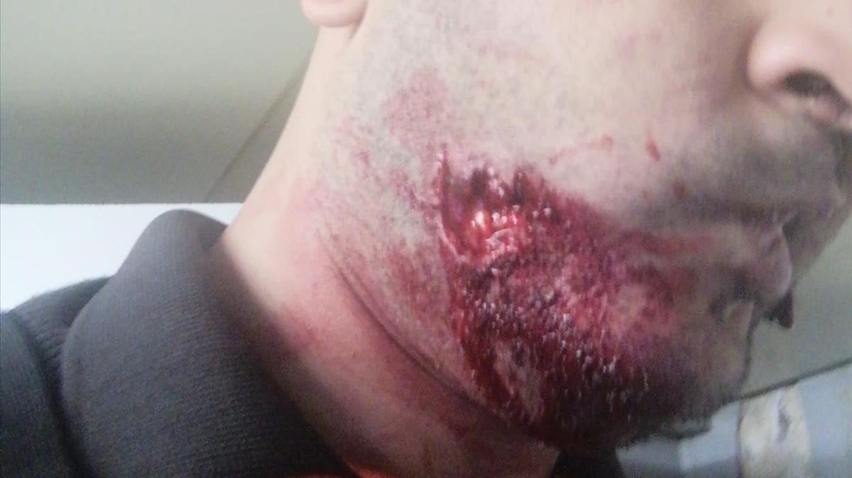 Detienen a un hombre por morder a un vigilante de seguridad del Metro de Barcelona Detienen a un hombre por morder a un vigilante de seguridad del Metro de Barcelona