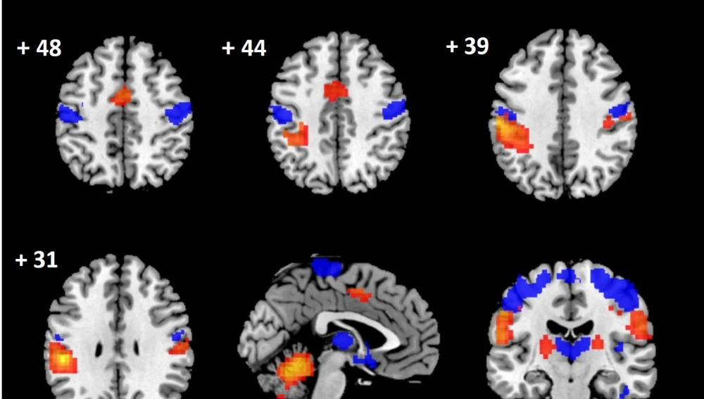 Imágenes del cerebro obtenidas en el estudio.