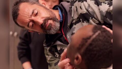 El doctor Cavadas extirpa un tumor a un ni&ntilde;o de 10 a&ntilde;os "m&aacute;s grande que su cabeza"