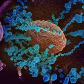 Imagen de microscopio del SARS-CoV-2 Imagen de microscopio del SARS-CoV-2