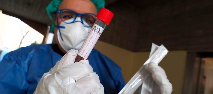 CGT SAySEP denuncia el riesgo para la población de la ausencia de tests del covid-19 para el personal de hospitales y centros de riesgo CGT SAySEP denuncia el riesgo para la población de la ausencia de tests del covid-19 para el personal de hospitales y centros de riesgo