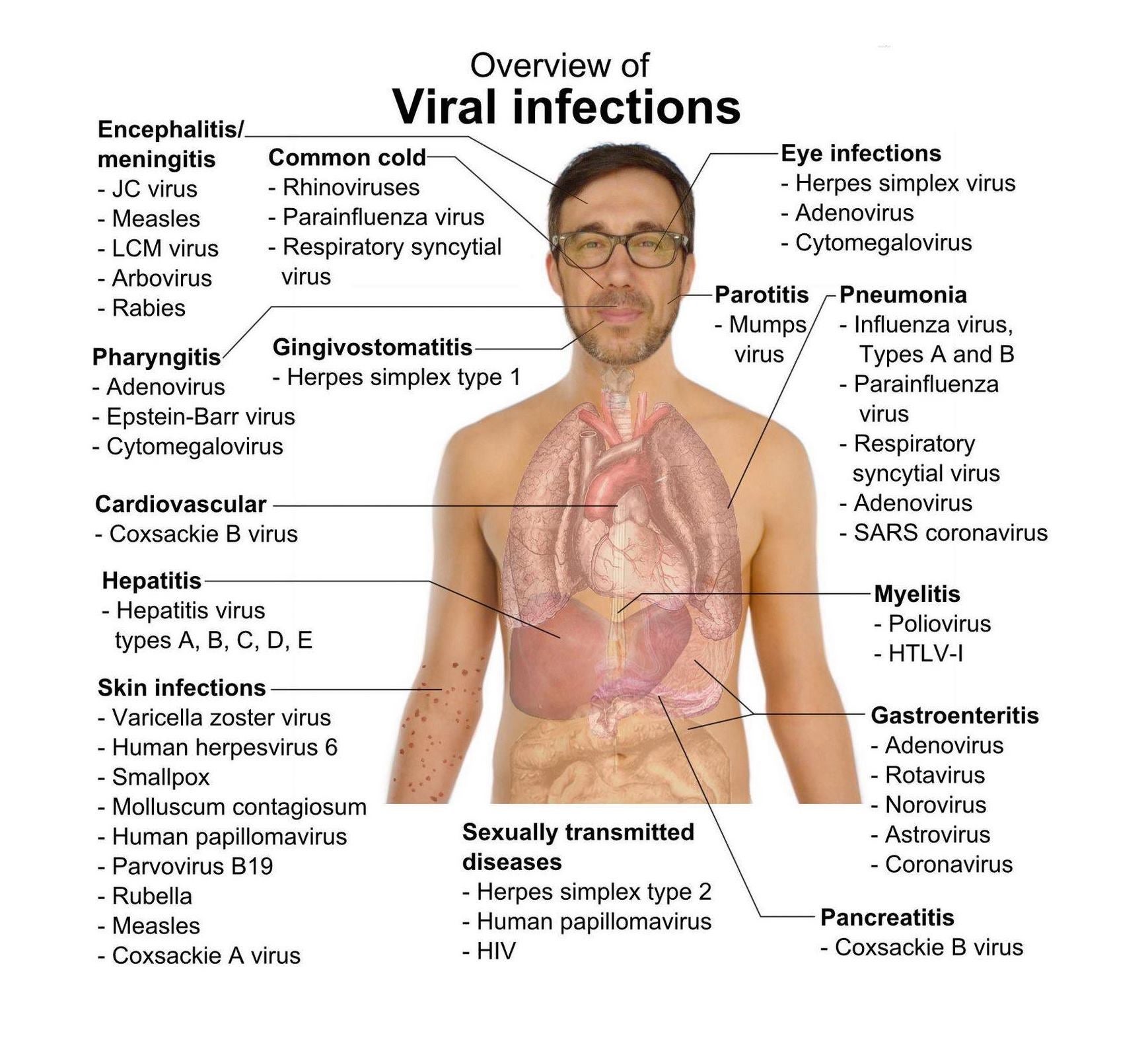 Vol. 229 "Virus" Vol. 229 "Virus"