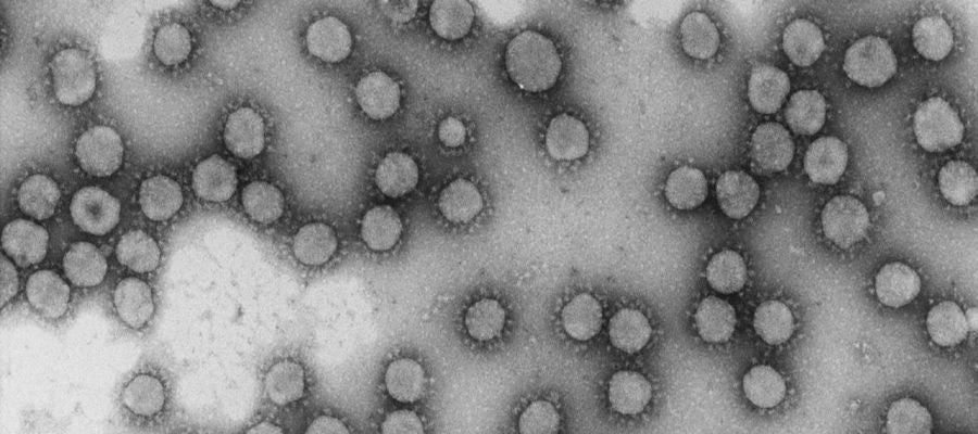 Virus de la familia Coronaviridae. Virus de la familia Coronaviridae.
