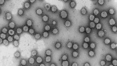 Virus de la familia Coronaviridae. Virus de la familia Coronaviridae.