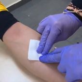El vídeo donde el Samur muestra cómo curar heridas domésticas 