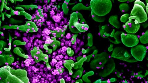 Coronavirus microscopio