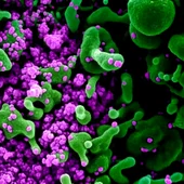 Imagen de un virus visto con el microscopio. Imagen de un virus visto con el microscopio.