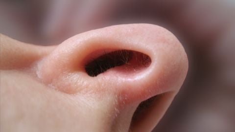 Una prueba de olfato predice la evolucion de pacientes con lesiones cerebrales graves