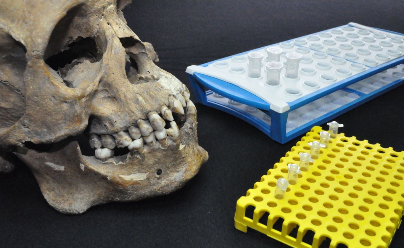 Cuéntame cómo pasó: La curiosa historia de un cráneo íbero Cuéntame cómo pasó: La curiosa historia de un cráneo íbero