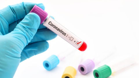 Positivo en coronavirus