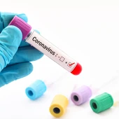 Positivo en coronavirus Positivo en coronavirus