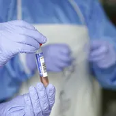 Muestra de coronavirus de un laboratorio. Muestra de coronavirus de un laboratorio.