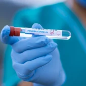 Prueba Covid-19 Prueba Covid-19