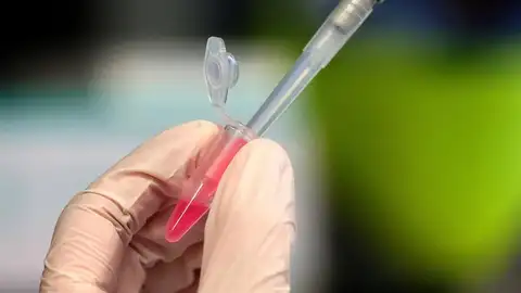 Test de coronavirus. coronavirus