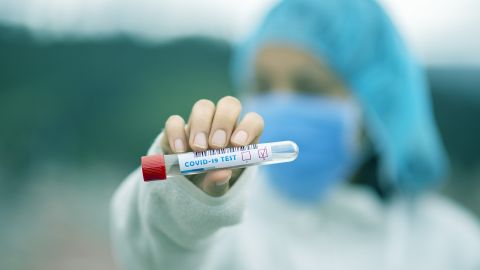 Una muestra de un test de Covid19