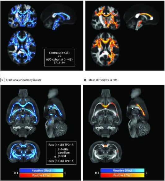 El consumo crónico de alcohol interacciona con el sistema inmune del cerebro y facilita la adicción El consumo crónico de alcohol interacciona con el sistema inmune del cerebro y facilita la adicción