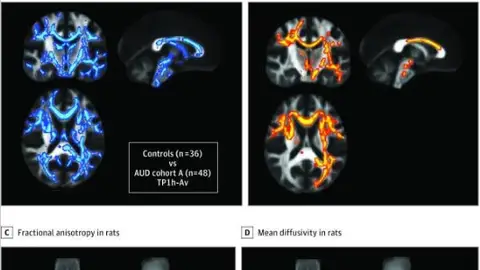 Estructura del cerebro en la adicción. Estructura del cerebro en la adicción.