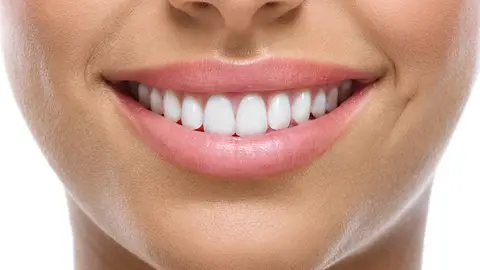 Sonrisa Sonrisa