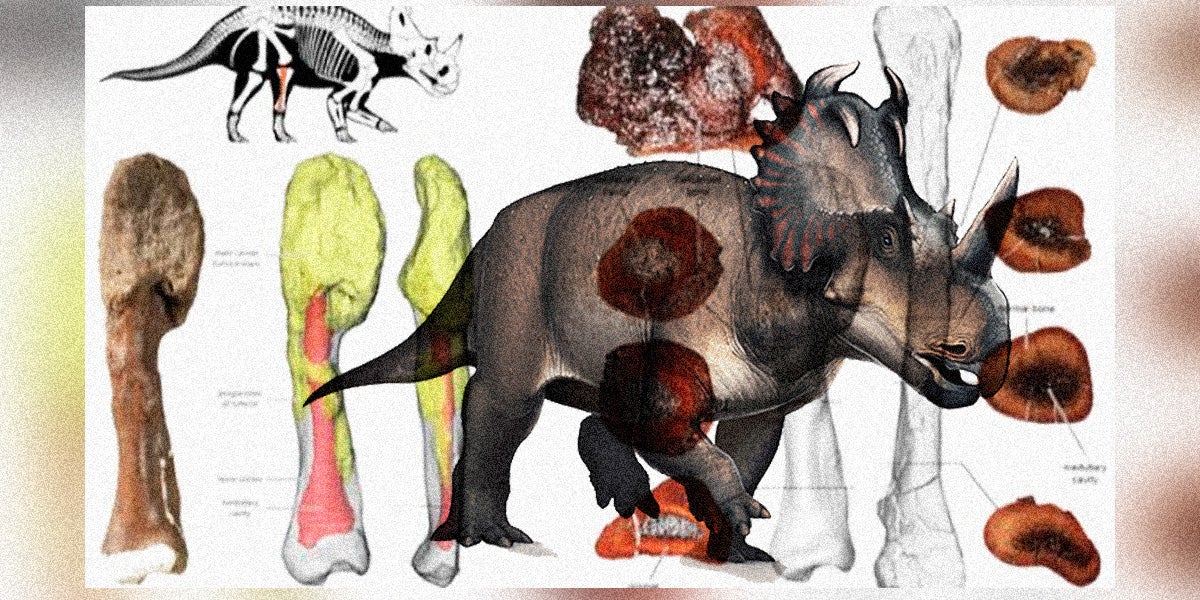 Descubren un cáncer de hueso en un dinosaurio que vivió hace 77 millones de años Descubren un cáncer de hueso en un dinosaurio que vivió hace 77 millones de años