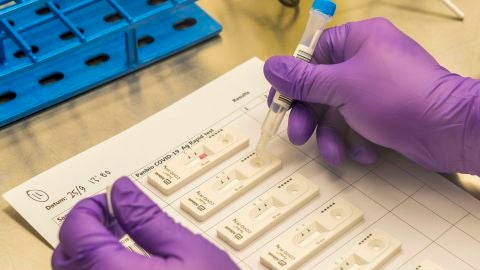 Enfermeros piden regular el precio de los test de ant&iacute;genos 