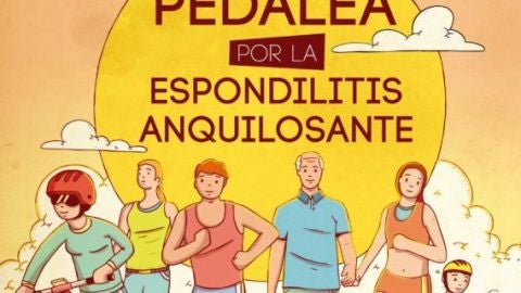Espondilitis anquilosante