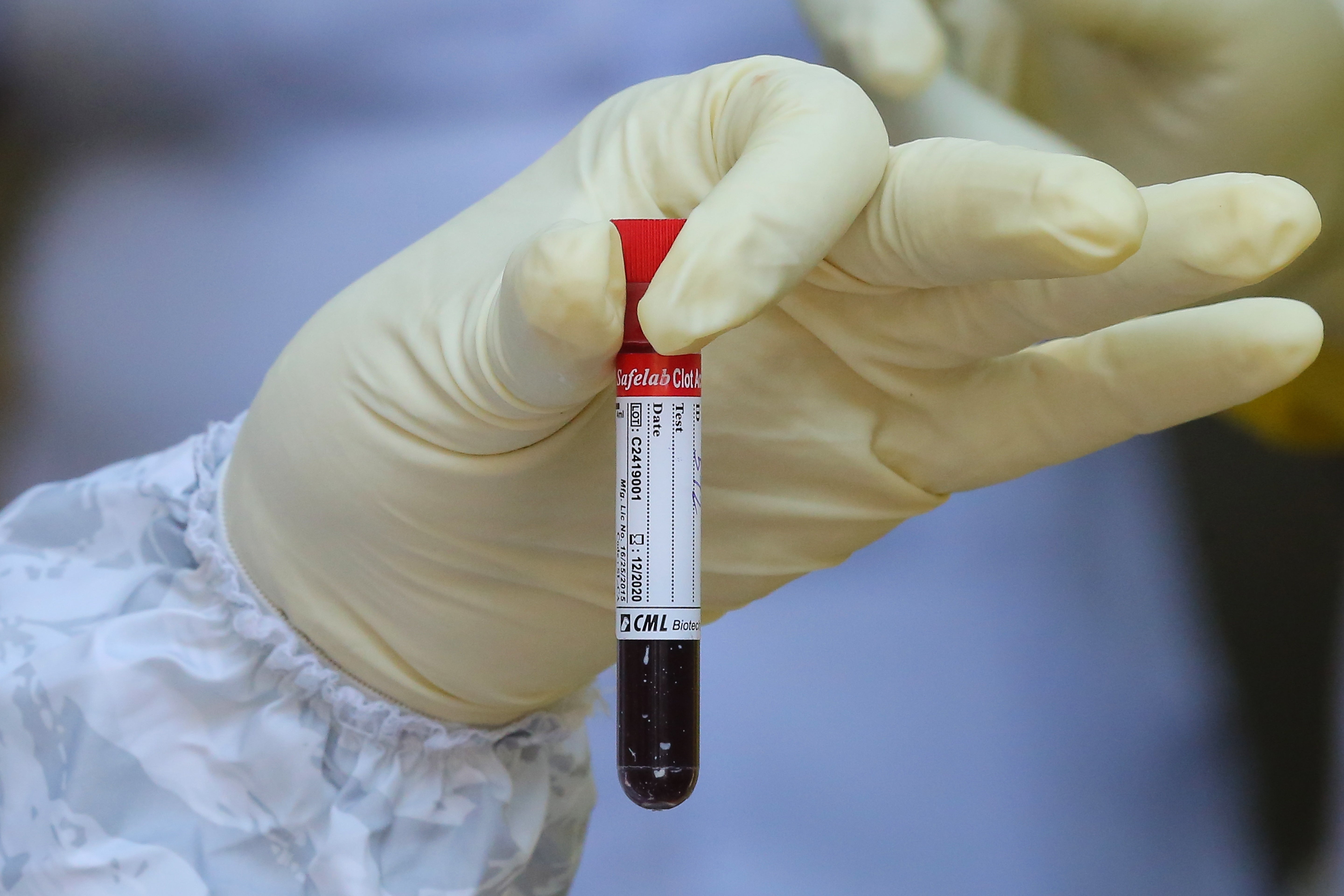 ¿Puedo donar sangre si me he vacunado contra la covid-19? ¿Puedo donar sangre si me he vacunado contra la covid-19?