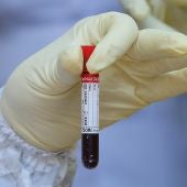 Un científico sostiene una muestra de sangre