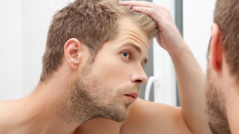 Microcirug&iacute;a FUE