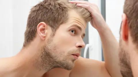 Microcirugía FUE Microcirugía FUE