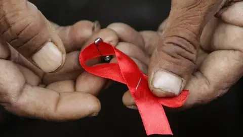 La Junta ha notificado cinco nuevas infecciones por el VIH en Palencia en 2020 SIDA