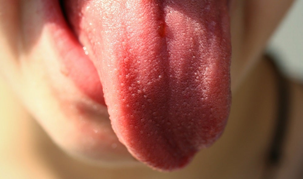 Alerta por la "lengua Covid", un nuevo síntoma del coronavirus Alerta por la "lengua Covid", un nuevo síntoma del coronavirus