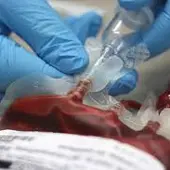 El Banco de Sangre de Extremadura obtendrá más plasma de positivos Covid para el tratamiento del coronavirus. El Banco de Sangre de Extremadura obtendrá más plasma de positivos Covid para el tratamiento del coronavirus.